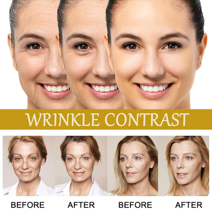 Advanced Bee Venom Serum, Anti-Aging Facial Serum, Face Serum to Help Refine Fine Lines & Wrinkles, Hydrating Facial Essence